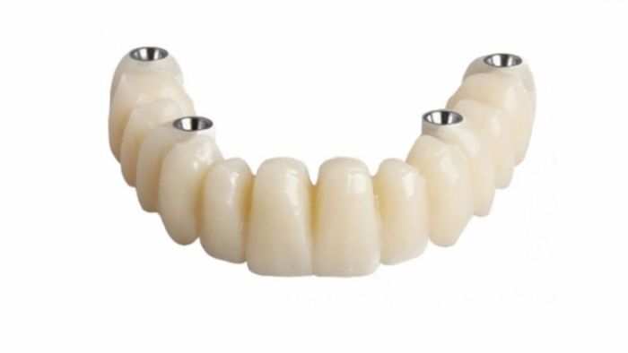 PMMA Resin Discs: The Diverse Radiance in Dental Applications